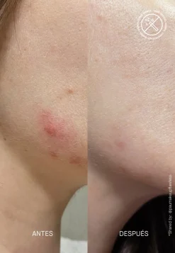 Outlet Serum & Kur ·Serum