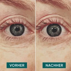 Best Augenpflege·Augenpflege