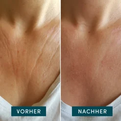 Discount Gesichtpflege·Hals & Décolleté