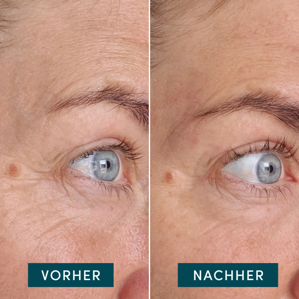 Sale Augenpflege·Augenpflege