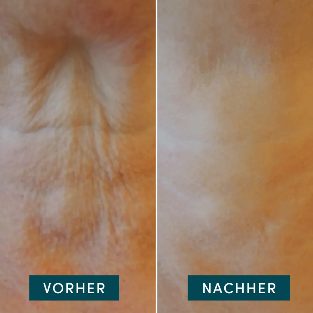 Sale Gesichtpflege·Hals & Décolleté