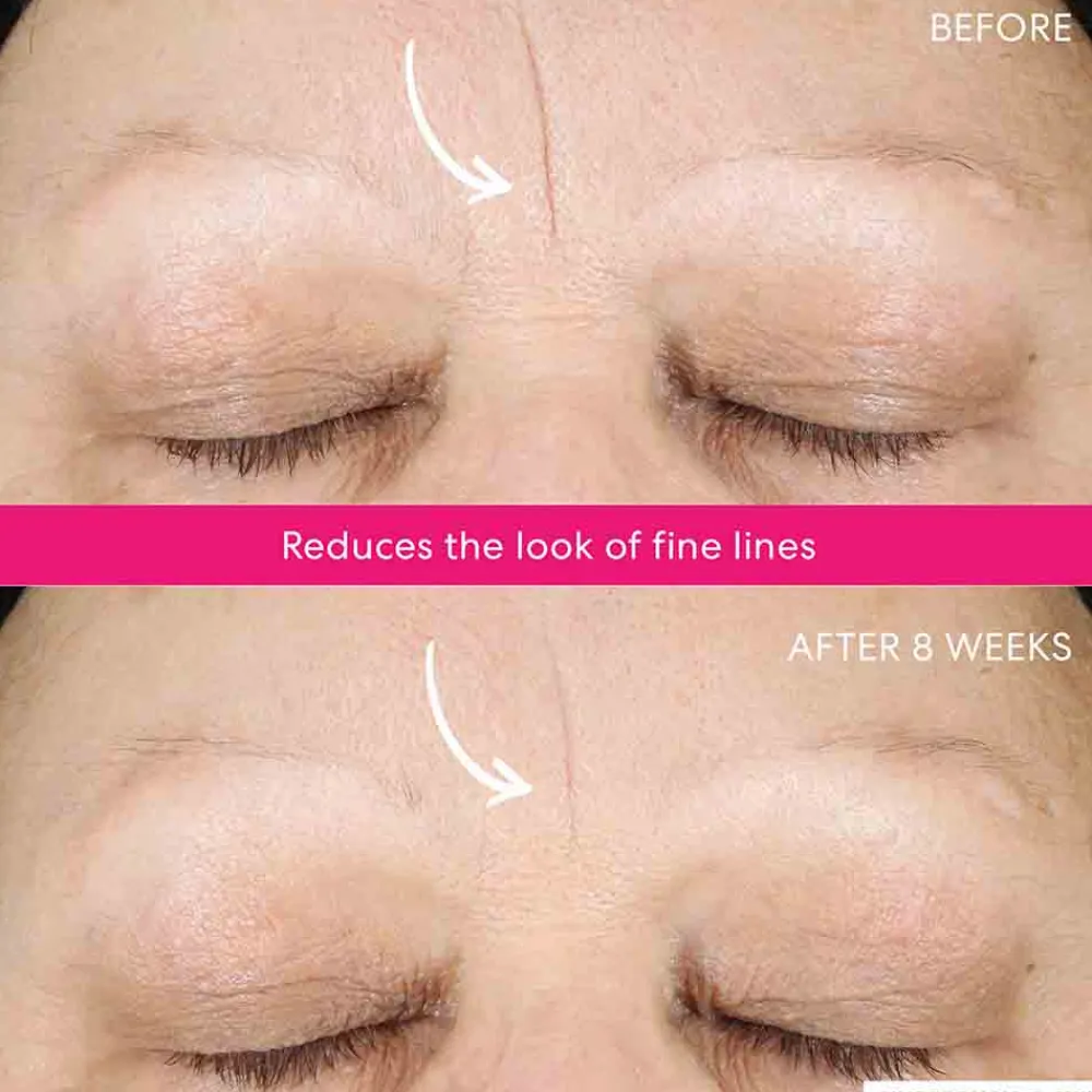 Best Reinigung·Gesichtspeeling|Gesichtpflege·Gesichtspflege