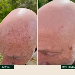 Online ·Kur & Serum