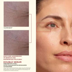 Outlet Serum & Kur ·Serum