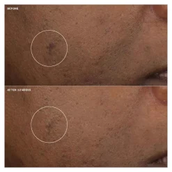 Online Gesichtpflege·Gesichtspflege