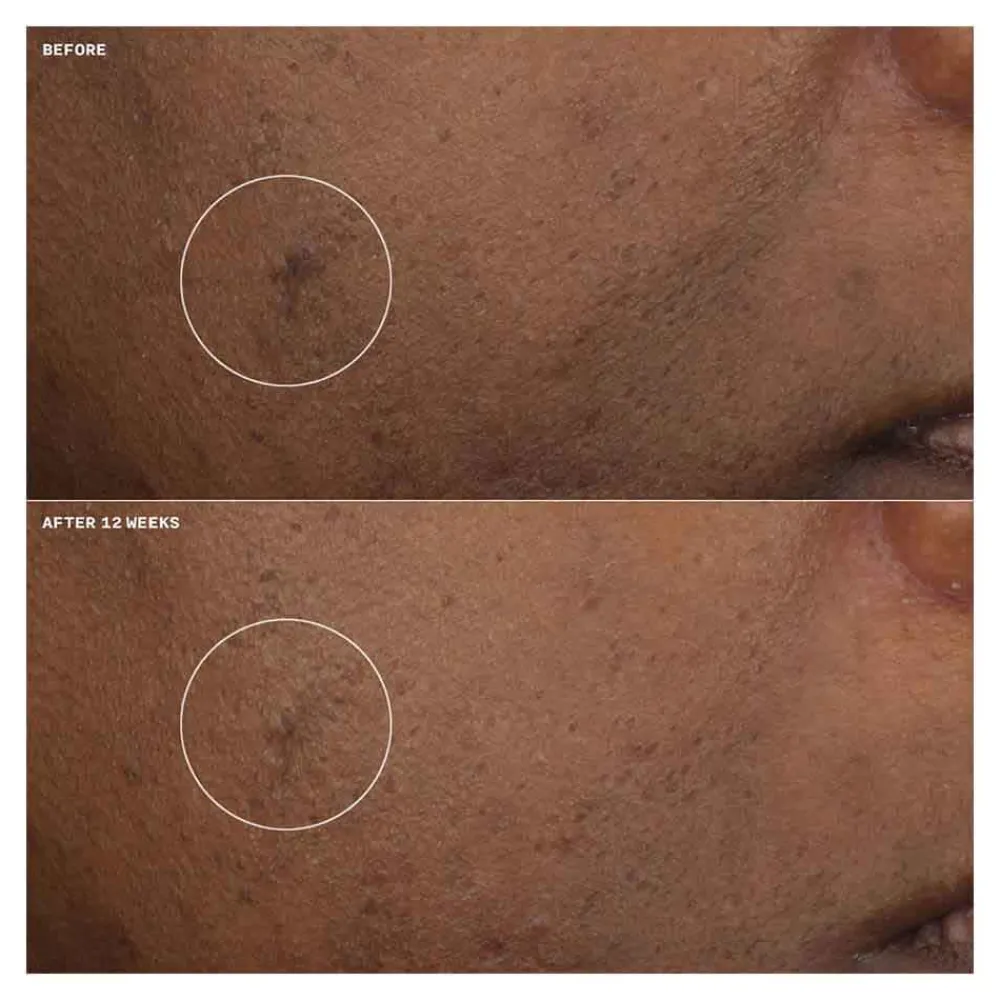 Online Gesichtpflege·Gesichtspflege