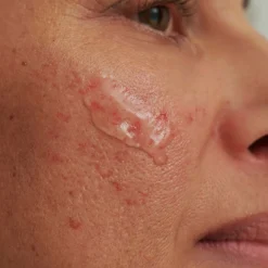 Discount Serum & Kur ·Serum