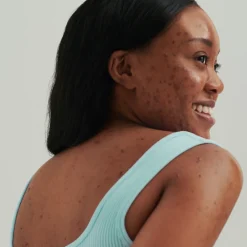 New Spezialpflege·Akne