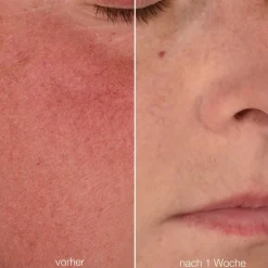 Discount Anti Aging·Anti-Aging