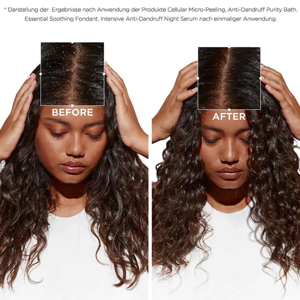 Best Shampoo·Shampoo