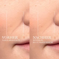 Hot Serum & Kur ·Serum